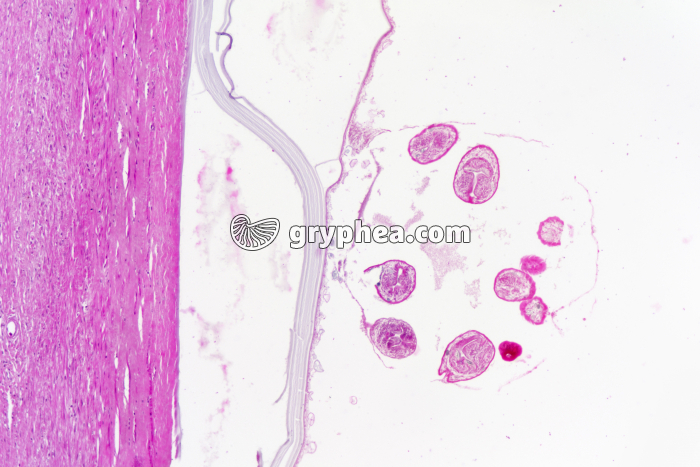 Taenia - ver parasite - Coupe de muscle ladre montrant un kyste hydatique - gryphea.org